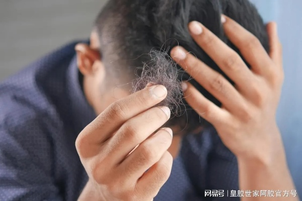 脱发危机下的年龄误判，30岁女子被误认为奶奶的尴尬现实